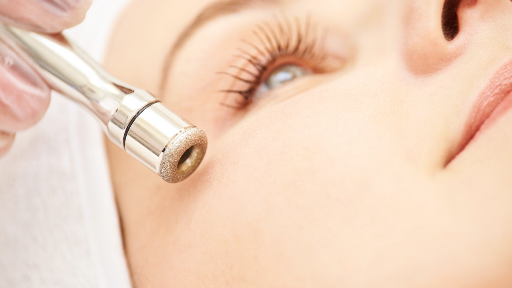 Close-up of a Microdermabrasion Tool on a Person's Face